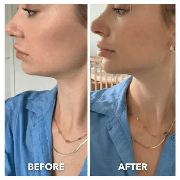Silkié Lift™ V-Line Sculpting Mask